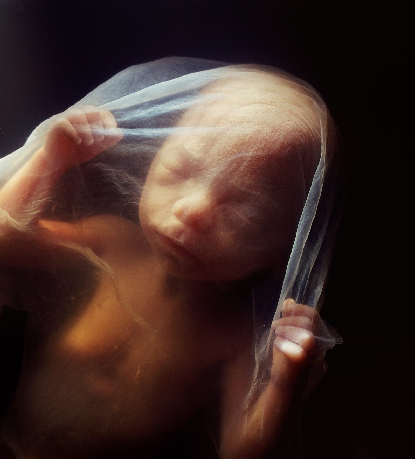 Womb Shadows: The Hidden Beginnings of Lifelong Diseases